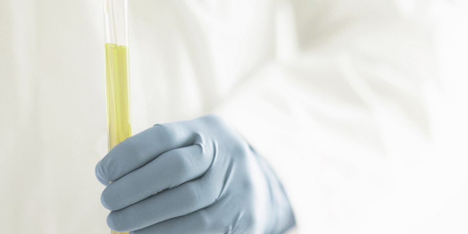 ACS Nano: Breakthrough! Scientists use biomarkers from urine for early cancer screening